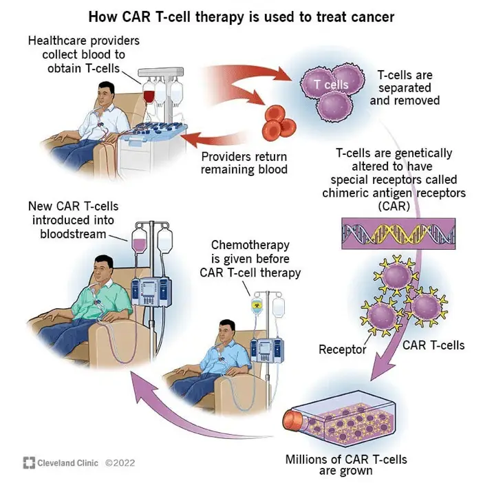 CAR T cell therapy